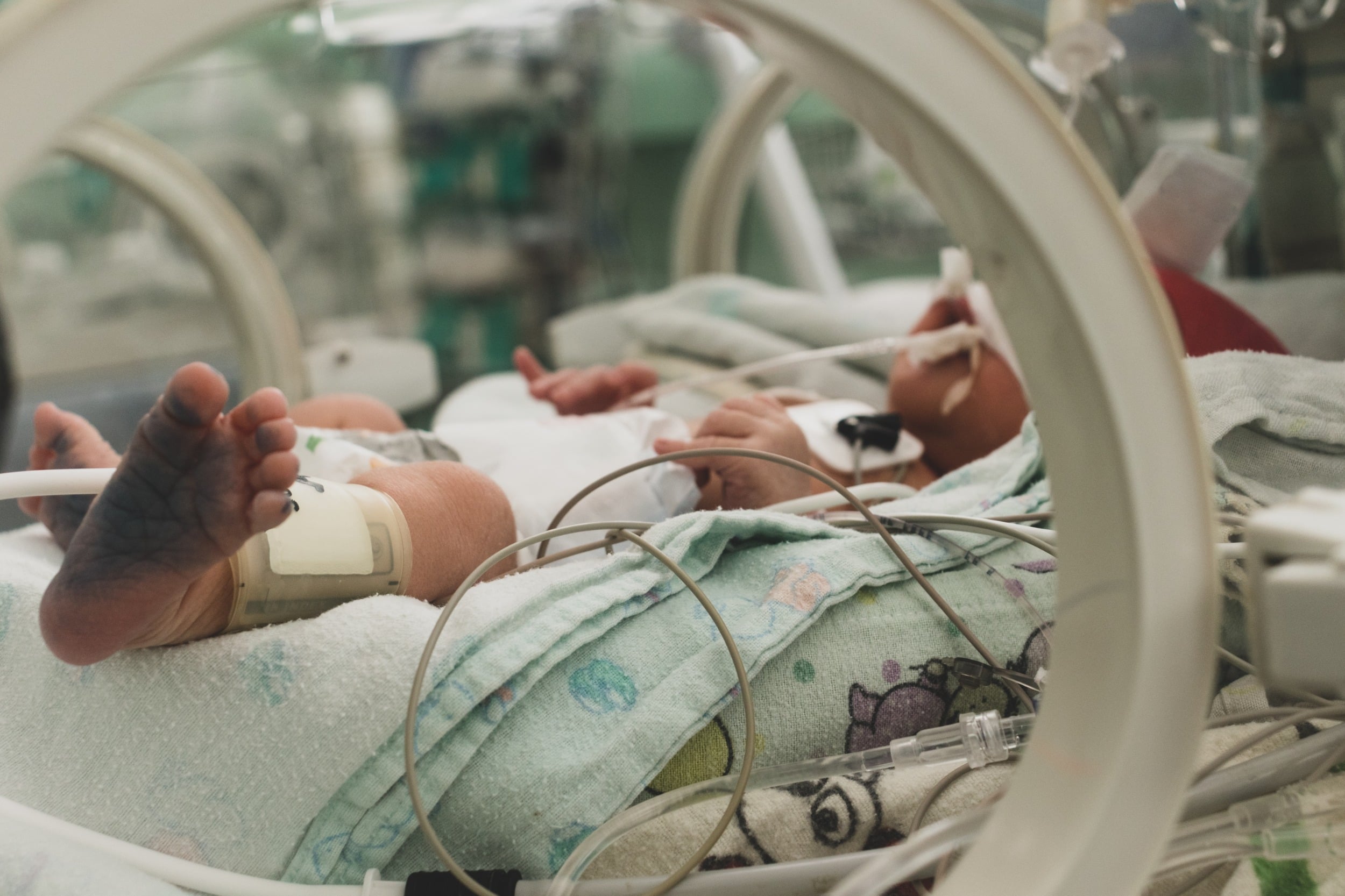 AdobeStock_296660437 birth injury